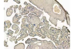 ABIN6257334 and ABIN6274315 at 1/100 staining human normal placenta tissue by IHC-P. (MVK antibody  (Internal Region))