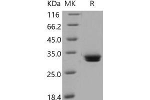 Western Blotting (WB) image for Carnitine Palmitoyltransferase 1B (Muscle) (CPT1B) protein (His tag) (ABIN7194637) (CPT1B Protein (His tag))