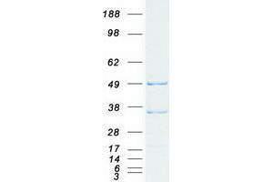 Western Blotting (WB) image for TNF Receptor-Associated Factor 3 (TRAF3) (Transcript Variant 3) protein (Myc-DYKDDDDK Tag) (ABIN2734113)
