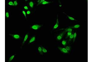 Immunofluorescence staining of Hela cells with ABIN7161811 at 1:533, counter-stained with DAPI. (C1D antibody  (AA 1-135))