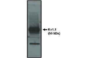 Western blot analysis using Kv1. (Kv1.1 Potassium Channel antibody)