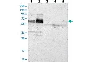 Western blot analysis of Lane 1: Negative control (vector only transfected HEK293T lysate). (ZNF135 antibody)