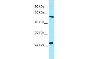 WB Suggested Anti-NCLN Antibody Titration: 1. (Nicalin antibody  (C-Term))