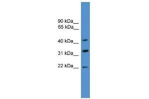 Western Blot showing ARFIP1 antibody used at a concentration of 1-2 ug/ml to detect its target protein. (ARFIP1 antibody  (C-Term))