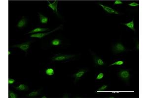 Immunofluorescence of monoclonal antibody to ID1 on HeLa cell. (ID1 antibody  (AA 47-155))