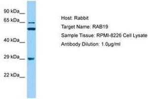 Image no. 1 for anti-RAB19, Member RAS Oncogene Family (RAB19) (AA 40-89) antibody (ABIN6749888) (RAB19 antibody  (AA 40-89))