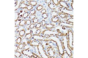 Immunohistochemistry (Paraffin-embedded Sections) (IHC (p)) image for anti-Cytochrome C, Somatic (CYCS) (AA 1-105) antibody (ABIN6139304)