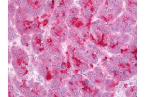 Human Pancreas: Formalin-Fixed, Paraffin-Embedded (FFPE) (MED13L antibody  (AA 750-800))