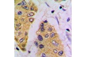 Immunohistochemical analysis of FBP1 staining in mouse pancreas formalin fixed paraffin embedded tissue section. (FBP1 antibody)