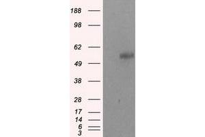 Image no. 2 for anti-Nucleotide Exchange Factor SIL1 (SIL1) antibody (ABIN1496811) (SIL1 antibody)