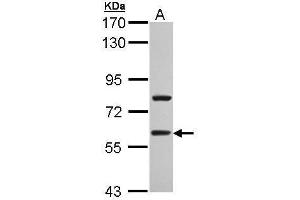 WB Image Sample (30 ug of whole cell lysate) A: A431 , 7. (TBL1XR1 antibody)