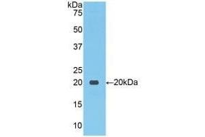Detection of Recombinant NCCT, Human using Polyclonal Antibody to Na-Cl Cotransporter (NCCT) (SLC12A3 antibody  (AA 867-1024))