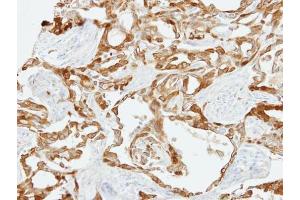 IHC-P Image Immunohistochemical analysis of paraffin-embedded H661 xenograft, using Fibulin 2, antibody at 1:500 dilution.