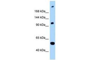 Image no. 1 for anti-L1 Cell Adhesion Molecule (L1CAM) (C-Term) antibody (ABIN6748014) (L1CAM antibody  (C-Term))
