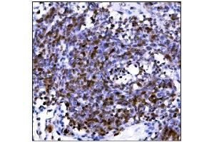 IHC analysis of PML Protein/Pml using anti-PML Protein/Pml antibody (ABIN7599678).