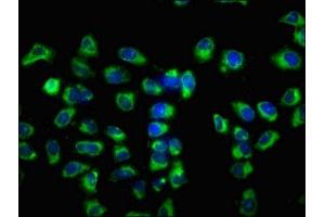 Immunofluorescence staining of Hela cells with ABIN7175196 at 1:133, counter-stained with DAPI. (VSIG8 antibody  (AA 285-414))