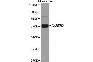 Western blot analysis of extracts of mouse liver, using GABRB2 antibody (ABIN5970962) at 1/1000 dilution. (GABRB2 antibody)