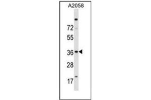 Western blot analysis of Islet-2 / ISL2 Antibody (N-term) in A2058 cell line lysates (35ug/lane). (ISL2 antibody  (N-Term))