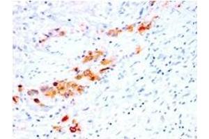 Formalin-fixed, paraffin-embedded human Bladder stained with CD44v4 Mouse Recombinant Monoclonal Antibody (rCD44v4/1219). (Recombinant CD44 antibody)