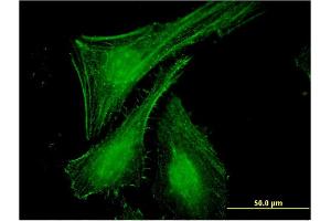 Immunofluorescence of monoclonal antibody to SLC27A2 on HeLa cell. (SLC27A2 antibody  (AA 25-123))