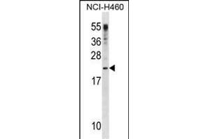 CSF3 Antibody (C-term) (ABIN1881232 and ABIN2838611) western blot analysis in NCI- cell line lysates (35 μg/lane). (G-CSF antibody  (C-Term))