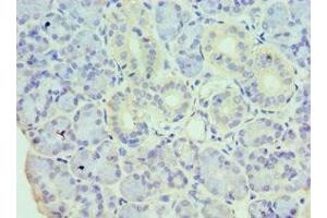 Immunohistochemistry of paraffin-embedded human pancreatic tissue using ABIN7155328 at dilution of 1:100 (HDAC8 antibody  (AA 1-377))