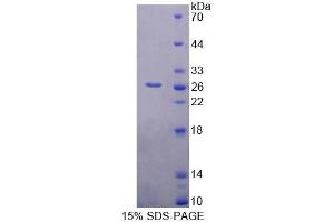 SDS-PAGE (SDS) image for BCL2-Associated Athanogene (BAG1) (AA 177-358) protein (His tag) (ABIN4990376) (BAG1 Protein (AA 177-358) (His tag))