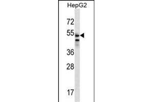 SLC29A3 Antibody (N-term) (ABIN656792 and ABIN2846011) western blot analysis in HepG2 cell line lysates (35 μg/lane). (SLC29A3 antibody  (N-Term))