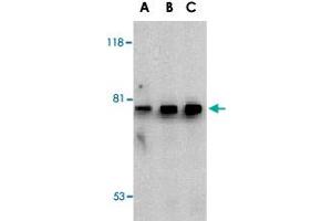 Western blot analysis of BTK in U-937 cell lysate with BTK polyclonal antibody  at (A) 0. (BTK antibody  (N-Term))
