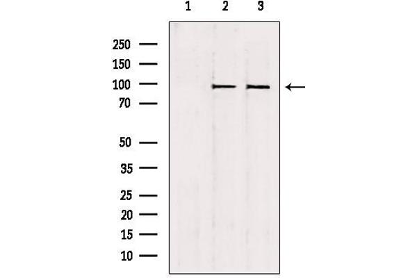 NSUN2 antibody  (Internal Region)