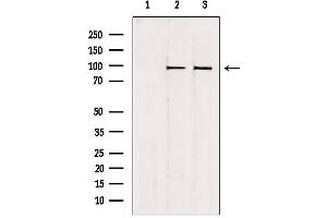 Western blot analysis of extracts from various samples, using NSUN2 antibody. (NSUN2 antibody  (Internal Region))