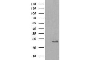 Image no. 1 for anti-HRas proto-oncogene, GTPase (HRAS) antibody (ABIN1498717) (HRAS antibody)