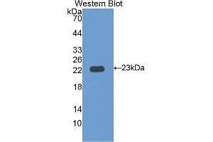 Western Blotting (WB) image for anti-Interleukin 12 Receptor beta 1 (IL12RB1) (AA 37-234) antibody (ABIN1174856) (IL12RB1 antibody  (AA 37-234))