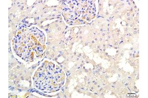 Formalin-fixed and paraffin embedded rat kidney labeled with Anti PNMT Polyclonal Antibody, Unconjugated  at 1:300 followed by conjugation to the secondary antibody and DAB staining (PNMT antibody  (AA 101-200))