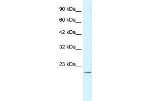 WB Suggested Antibody  Titration: 0. (FOXP2 antibody  (N-Term))