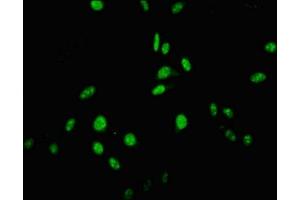 Immunofluorescent analysis of Hela cells using ABIN7174288 at dilution of 1:100 and Alexa Fluor 488-congugated AffiniPure Goat Anti-Rabbit IgG(H+L) (USP22 antibody  (C-Term))