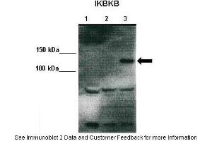 Lanes:   Lane 1: 10ug 293T lysate (empty vector) Lane 2: 10ug IKKalpha-V5 transfected 293T lysate Lane 3: 10ug IKKbeta-V5 transfected 293T  Primary Antibody Dilution:    1:1000  Secondary Antibody:   Anti-rabbit HRP  Secondary Antibody Dilution:    1:2000  Gene Name:   IKBKB  Submitted by:   Dr.