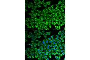 Immunofluorescence (IF) image for anti-Interleukin 12 Receptor beta 1 (IL12RB1) antibody (ABIN1980210) (IL12RB1 antibody)