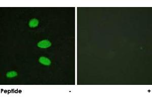 Immunofluorescence analysis of HeLa cells, using RBL2 polyclonal antibody .