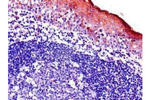 Immunohistochemistry of paraffin-embedded human tonsil tissue using ABIN7145203 at dilution of 1:100 (BIRC3 antibody  (AA 76-245))