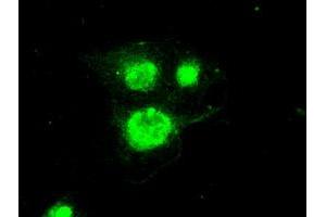 Image no. 1 for anti-Periostin (POSTN) (AA 1-230) antibody (ABIN1490615) (Periostin antibody  (AA 1-230))