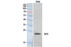 Western Blotting (WB) image for anti-Neurotensin (NTS) (Internal Region) antibody (ABIN3178551) (Neurotensin antibody  (Internal Region))