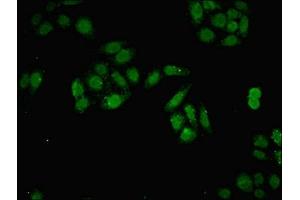 Immunofluorescent analysis of HepG2 cells using ABIN7150116 at dilution of 1:100 and Alexa Fluor 488-congugated AffiniPure Goat Anti-Rabbit IgG(H+L) (DNMT3B antibody  (AA 1-100))