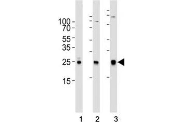 RAC1 antibody