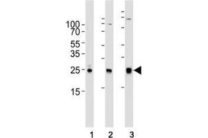 Western blot analysis of lysate from (1) human A431, (2) mouse NIH3T3, (3) rat C6 cell line using RAC1 antibody at 1:1000. (RAC1 antibody)