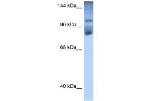 WB Suggested Anti-HIPK2 Antibody Titration:  0. (HIPK2 antibody  (Middle Region))