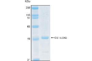 10% SDS-PAGE stained with Coomassie Blue (CB) and peptide fingerprinting by MALDI-TOF mass spectrometry (Lipocalin 2 Protein (LCN2) (AA 19-198) (GST tag))