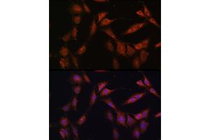 Immunofluorescence analysis of C6 cells using PFKFB2 Rabbit pAb (ABIN6129842, ABIN6145483, ABIN6145484 and ABIN6224971) at dilution of 1:100 (40x lens). (PFKFB2 antibody  (AA 446-505))
