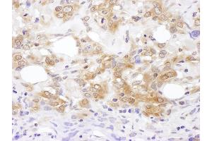 anti-Mitogen-Activated Protein Kinase Kinase 7 (MAP2K7) (AA 1-50) antibody