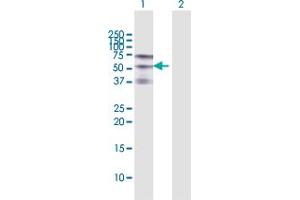 Western Blot analysis of ZSCAN20 expression in transfected 293T cell line by ZSCAN20 MaxPab polyclonal antibody. (ZSCAN20 antibody  (AA 1-433))